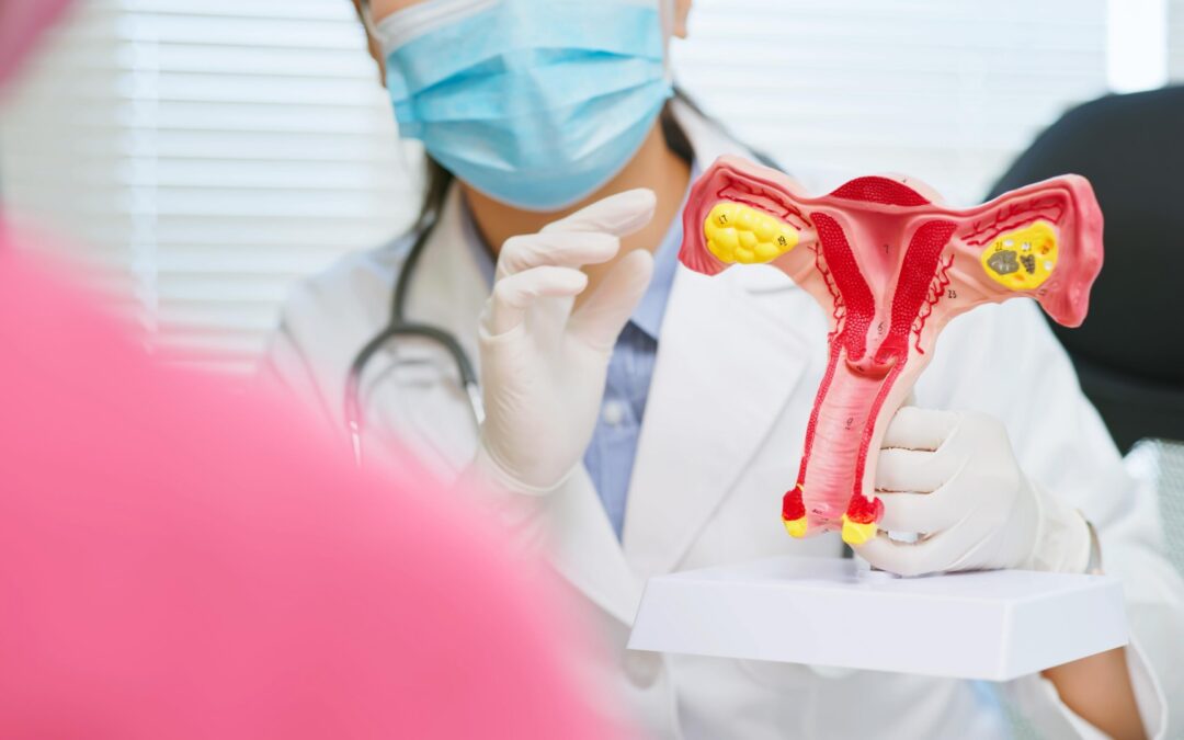 Le SOPK a été renommé PMOS; Pourquoi ce changement est important pour la santé des femmes